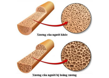 Hướng dẫn sử dụng calcium 600mg
