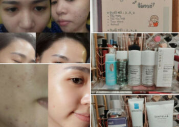 Twins skin retinol review